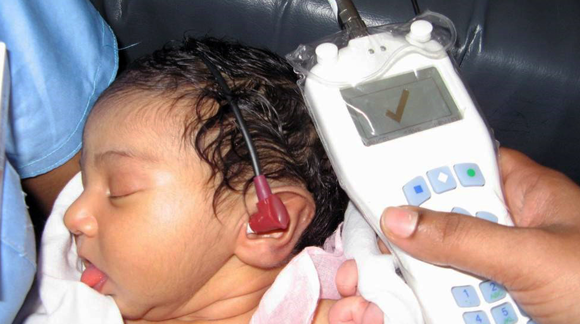 OAE Hearing Test | Otoacoustic Emissions Test | Otoacoustic Emissions Test For Newborns | OAE Hearing Test Near Me Delhi, India