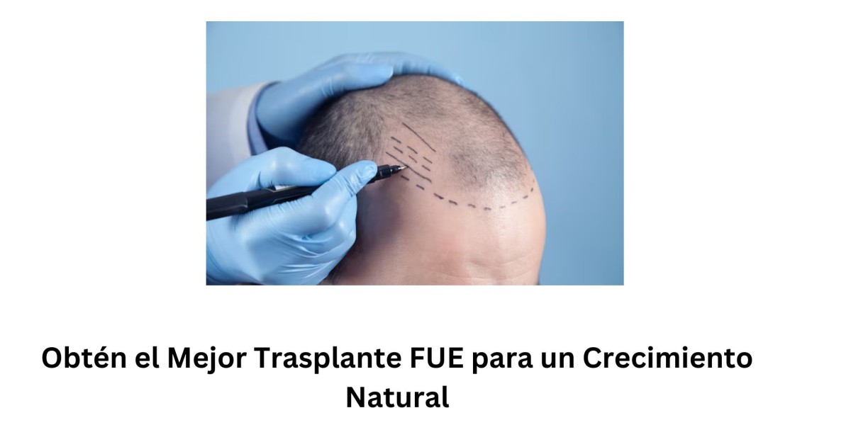 Obtén el Mejor Trasplante FUE para un Crecimiento Natural